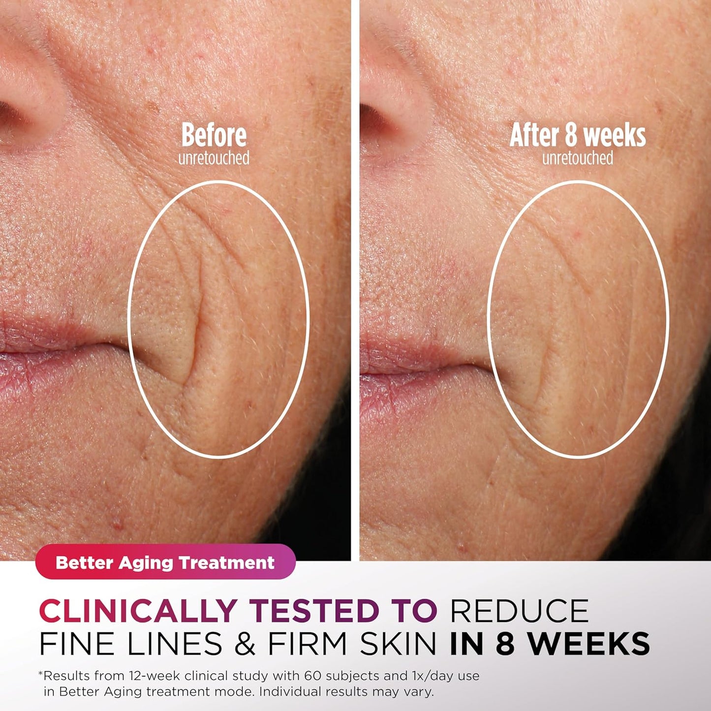 Shark CryoGlow – Mascarilla Facial LED con efecto refrescante para la zona debajo de los ojos | Terapia de Luz Roja/Azul/Infrarroja